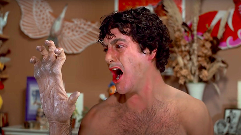 David Naughten's hand transforms in An American Werewolf in London