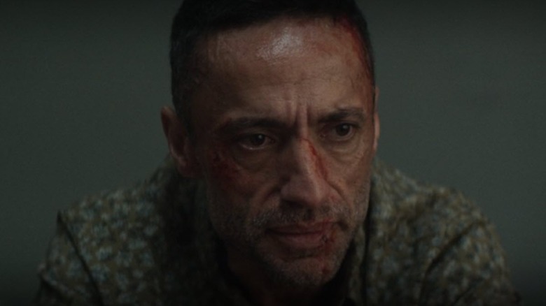 Hector Ayala looking bloodied and beaten-up in Daredevil: Born Again