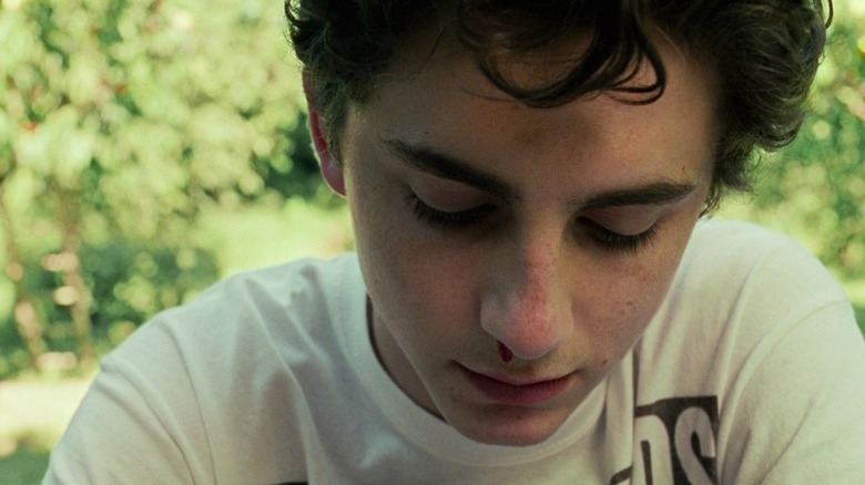 Elio bloody nose in Call Me by Your Name