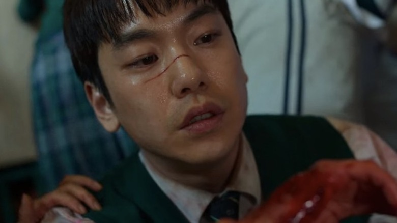 Joon-yeong scratched nose