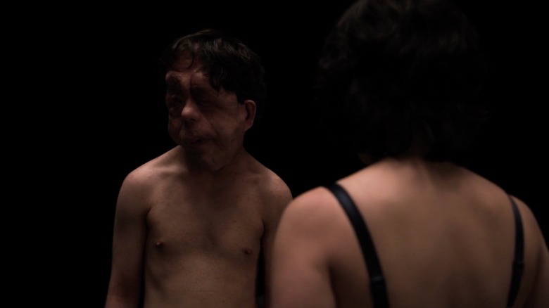 Under the Skin Adam Pearson